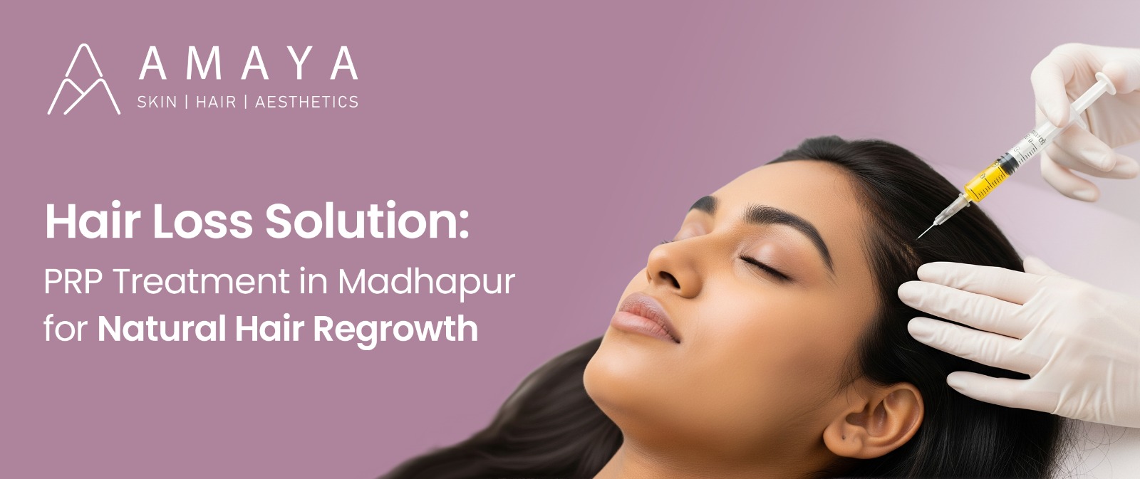Hair Loss Solution: PRP Treatment in Madhapur for Natural Hair Regrowth