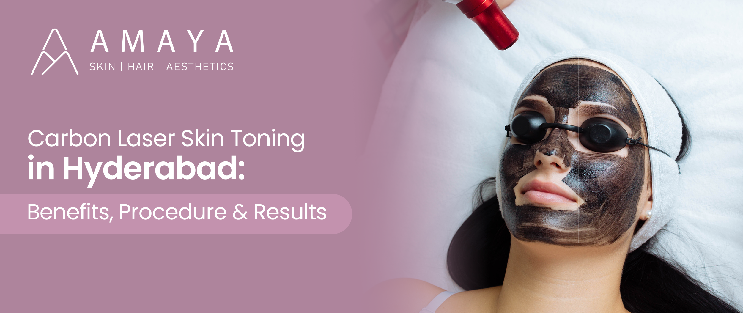 Carbon Laser Skin Toning in Hyderabad: Benefits, Procedure & Results
