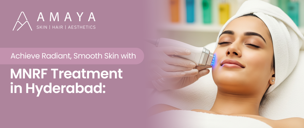 Achieve Radiant, Smooth Skin with MNRF Treatment in Hyderabad