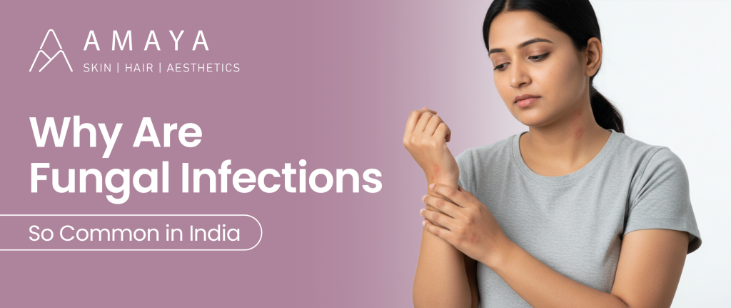 Why Are Fungal Infections So Common in India?