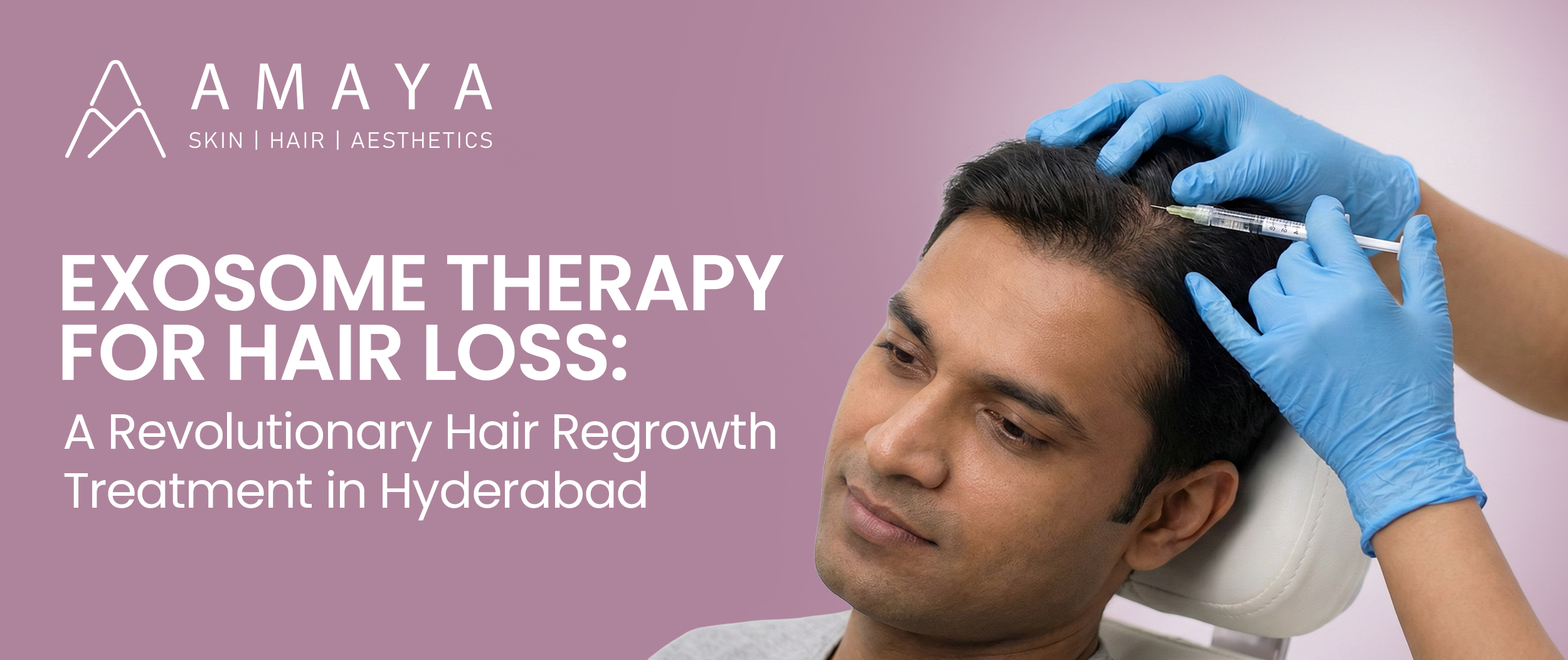 Exosome Therapy for Hair Loss: A Revolutionary Hair Regrowth Treatment in Hyderabad