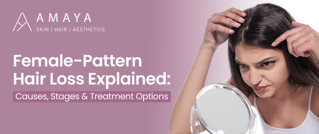 Female-Pattern Hair Loss Explained: Causes, Stages, and Treatment Options