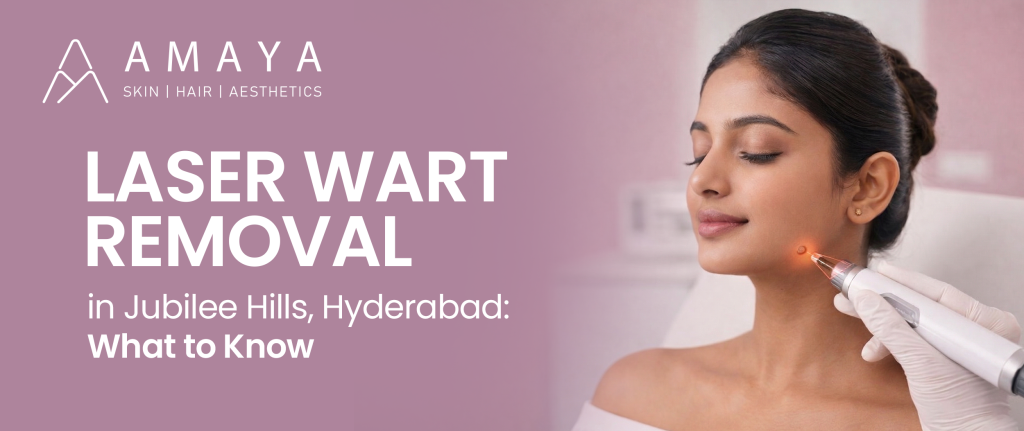 Laser Wart Removal in Jubilee Hills, Hyderabad: A Complete Guide