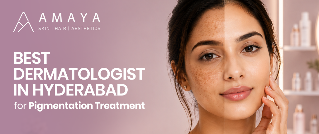 Best Dermatologist in Hyderabad for Pigmentation Treatment – Dr. Shama Reddy
