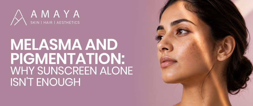 Melasma and Pigmentation: Why Sunscreen Alone Isn’t Enough