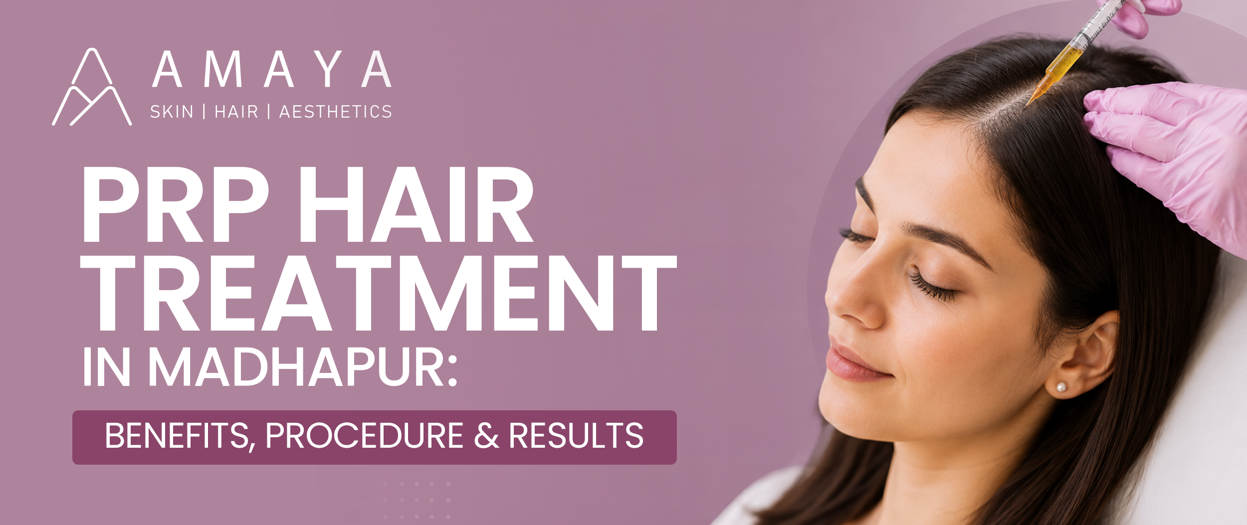 PRP Hair Treatment in Madhapur: Benefits, Procedure & Results