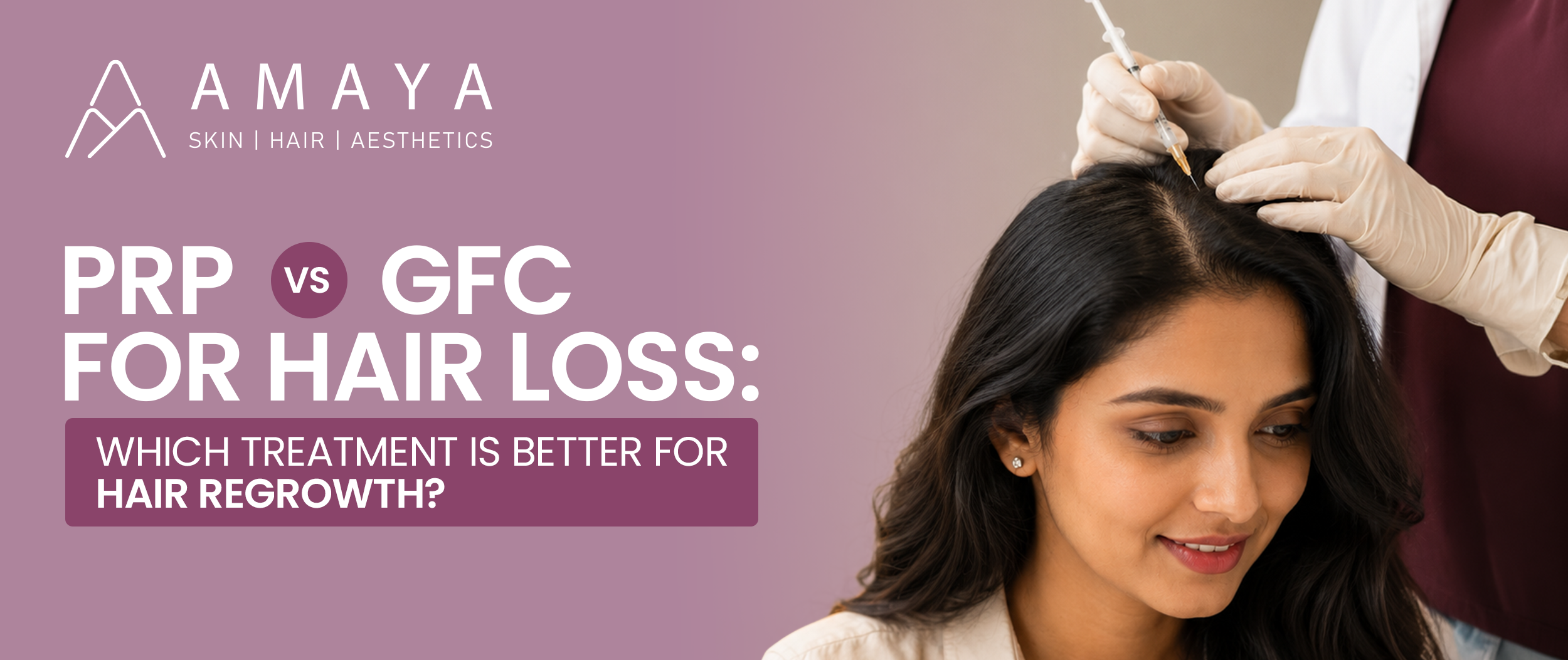 PRP vs GFC for Hair Loss: Which Treatment Is Better for Hair Regrowth?